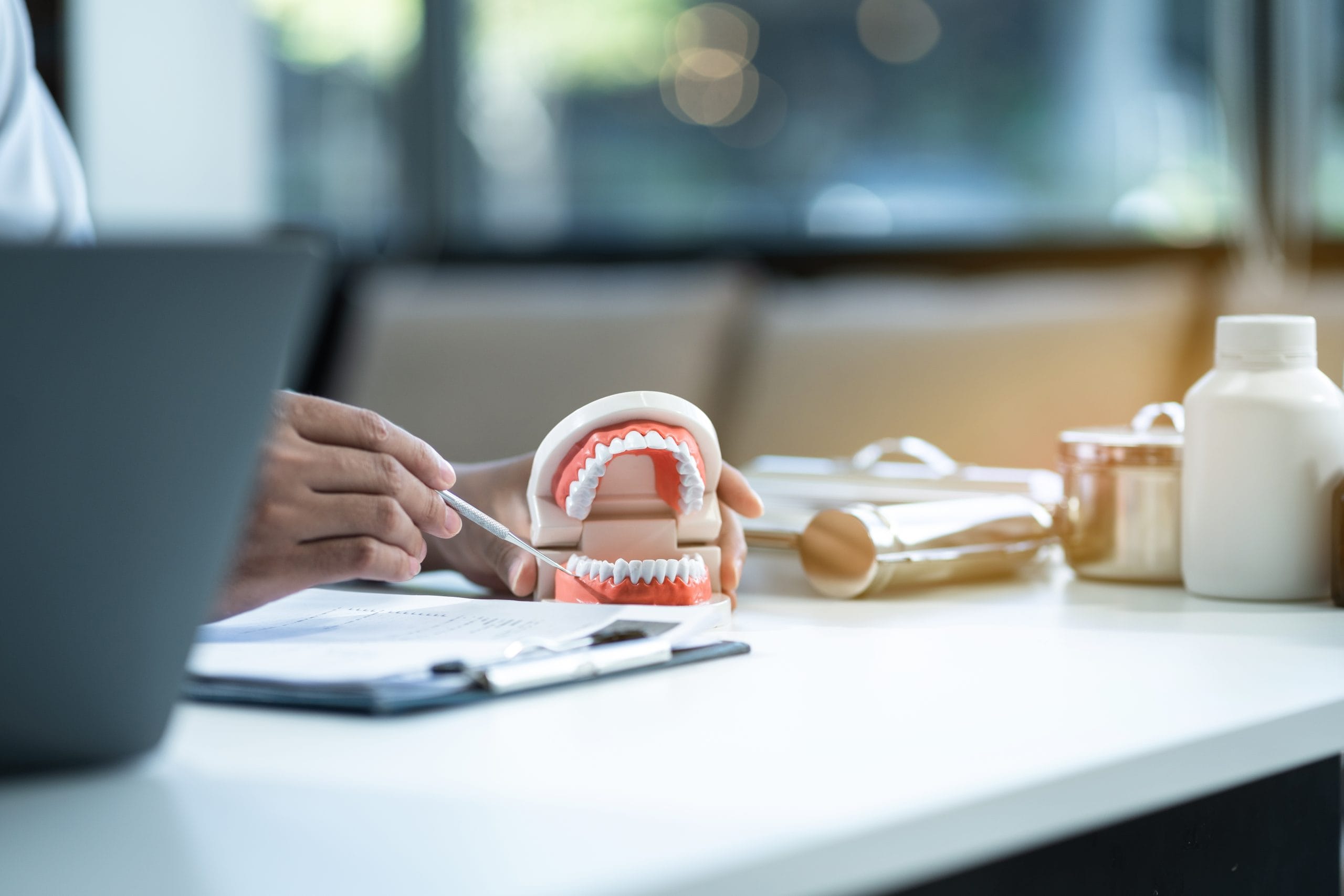 Featured image for “Tips for Presenting Full Mouth Implant Cases”